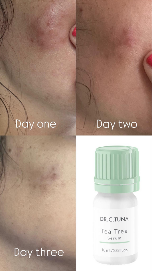 Tea Tree Serum