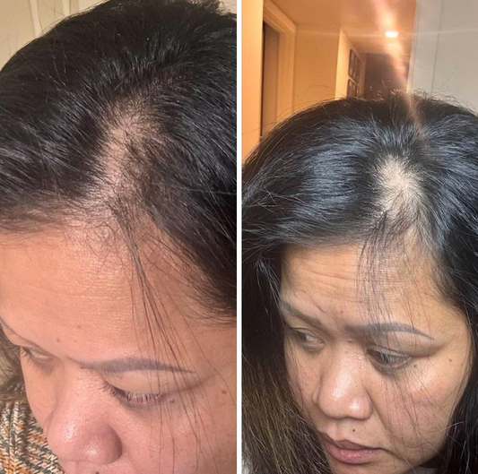 Reviving Hair Bundle