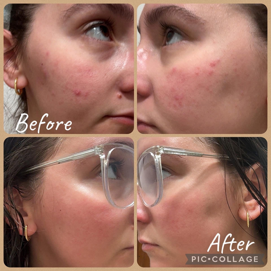 Calendula Face Toner
