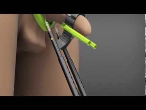 Penis Enlarger Kit