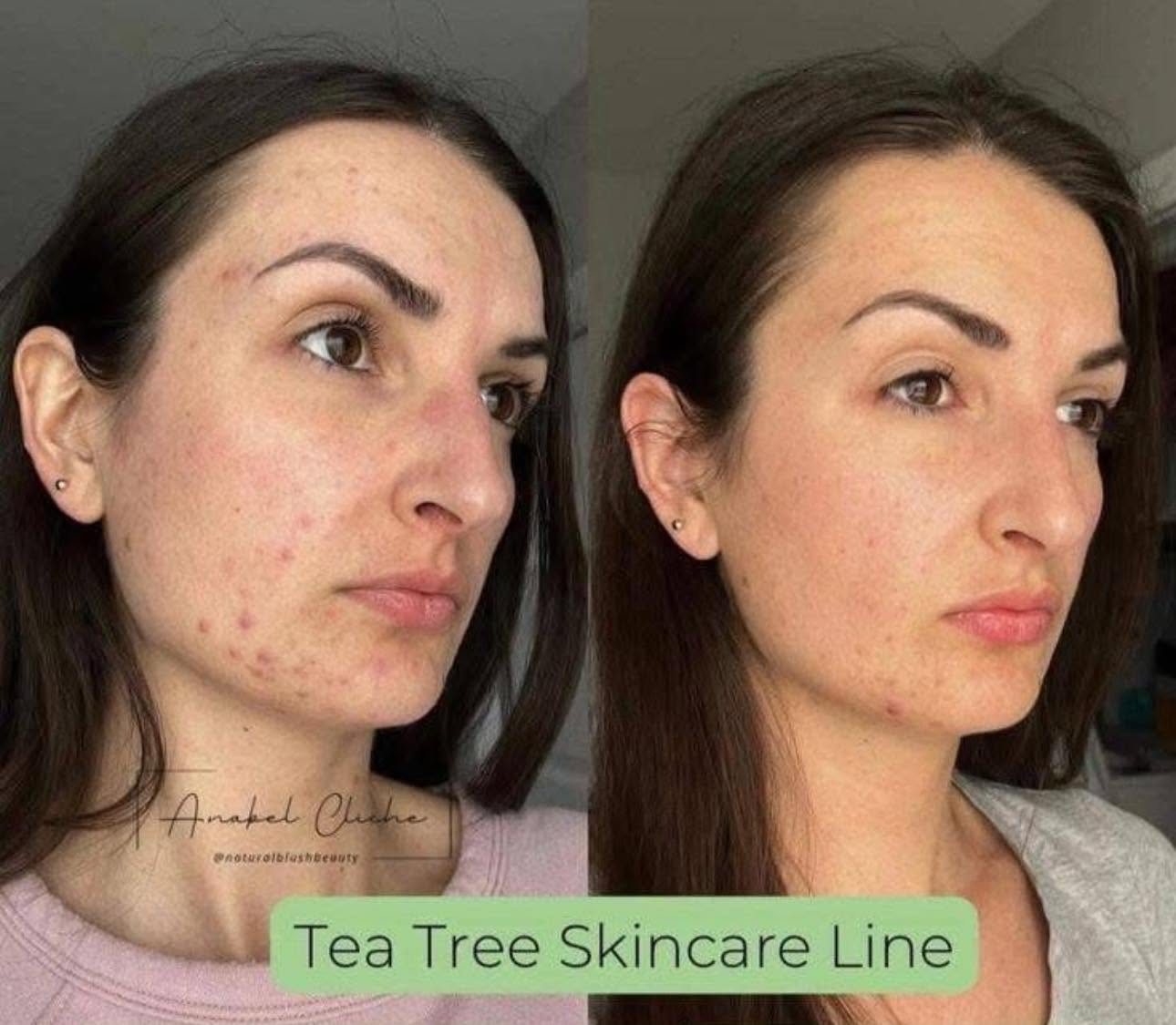 Tea Tree Face Wash