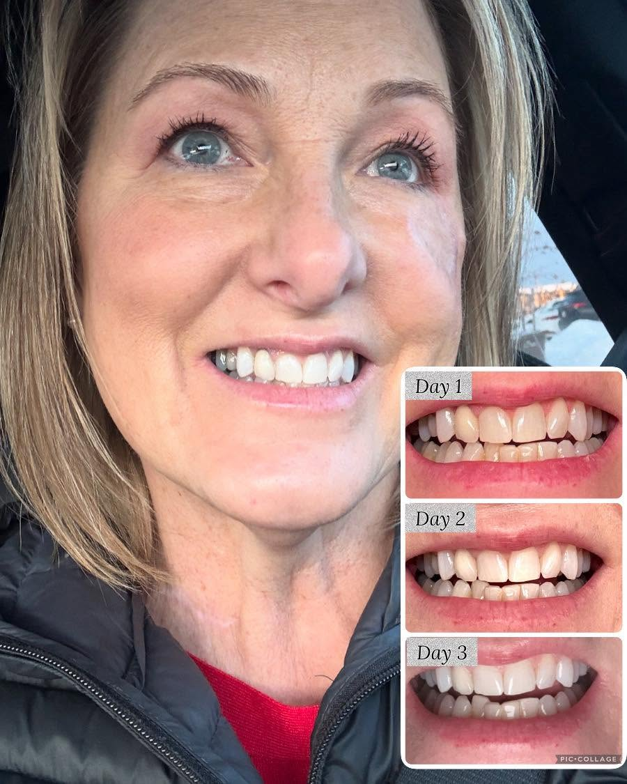Whitening Toothpaste - Fluoride Free