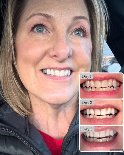 Whitening Toothpaste - Fluoride Free