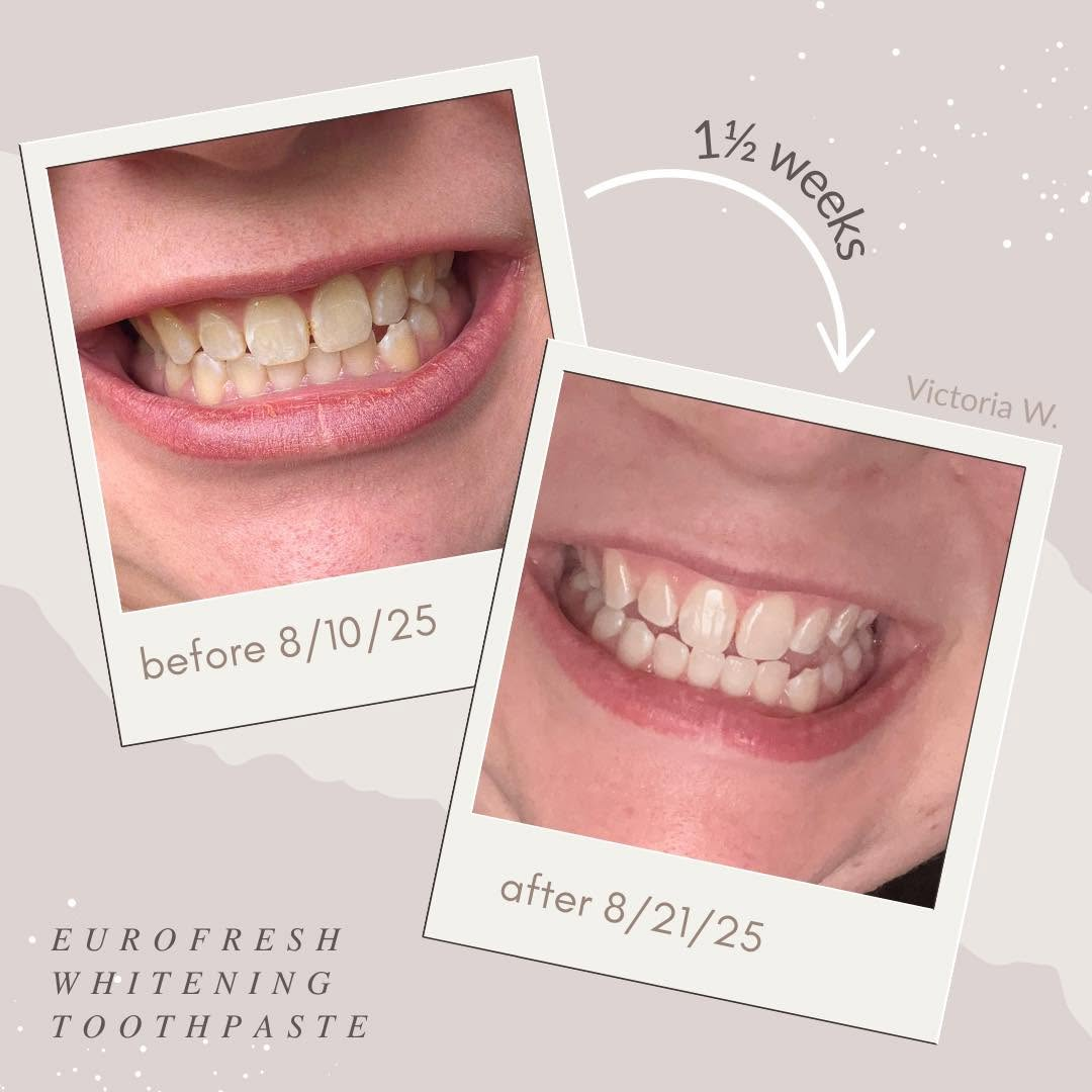Whitening Toothpaste - Fluoride Free