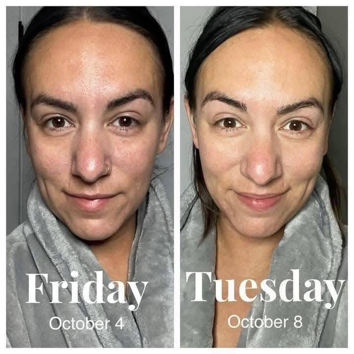 Vitamin C Glow Serum