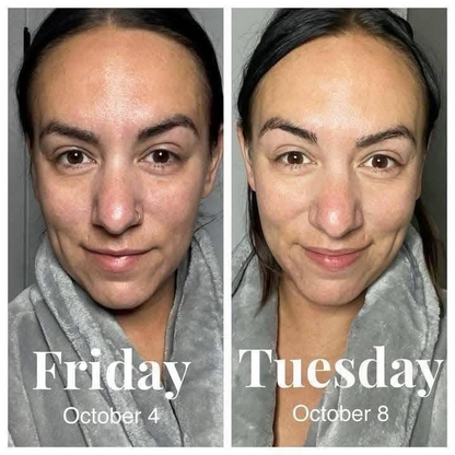 Vitamin C Glow Serum
